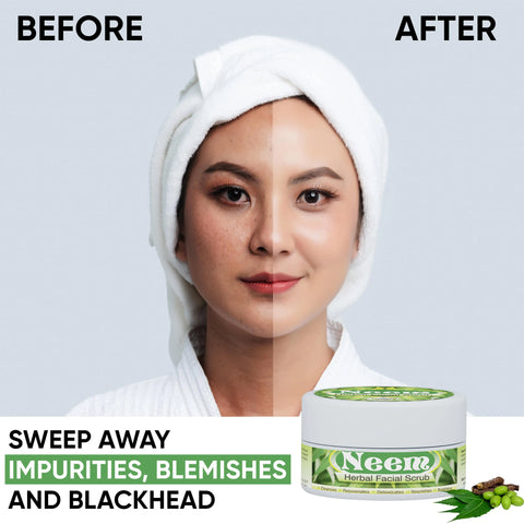Neem Facial Scrub (Wholesale)